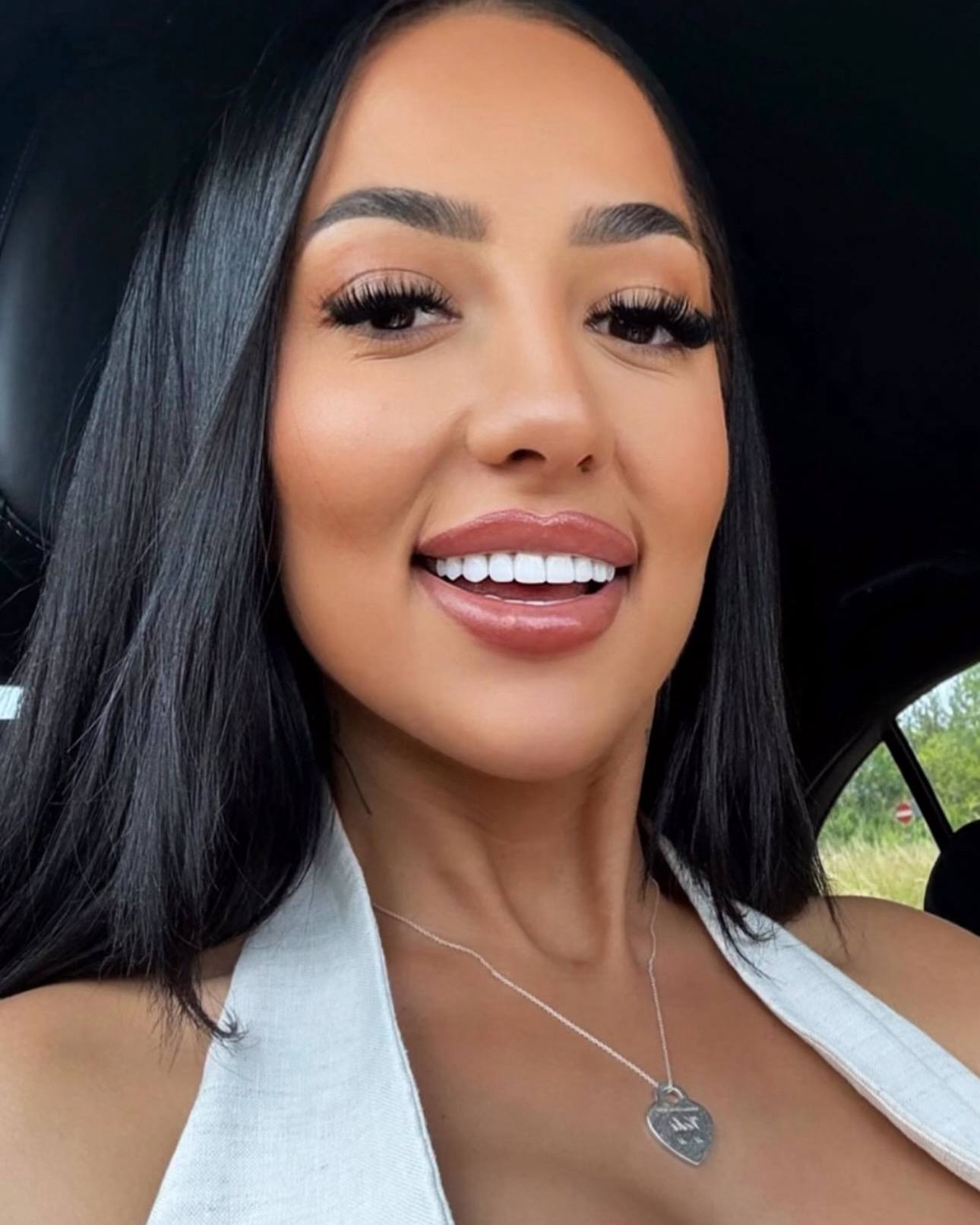 Patient smile after treatment