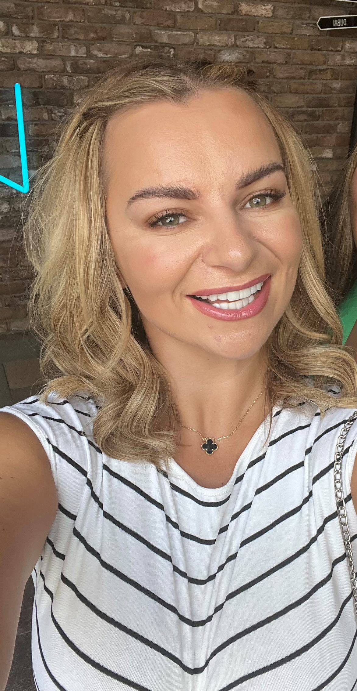 Patient smile after treatment