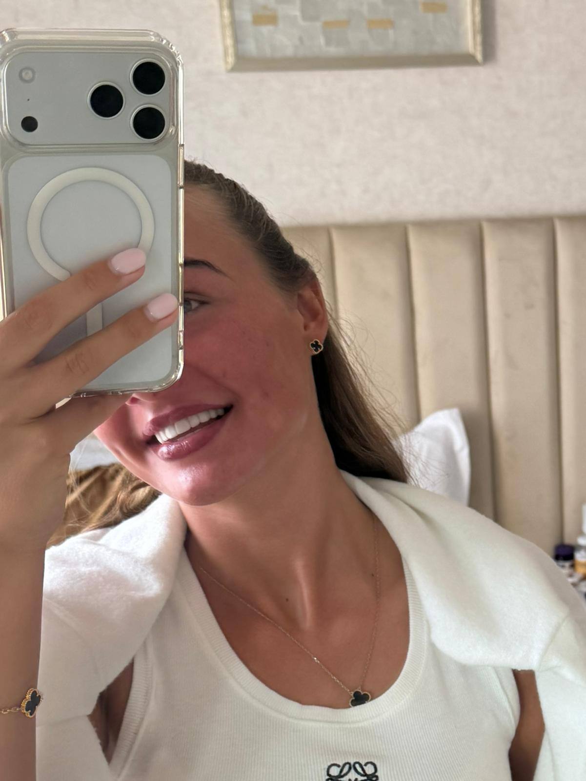 Patient smile after treatment