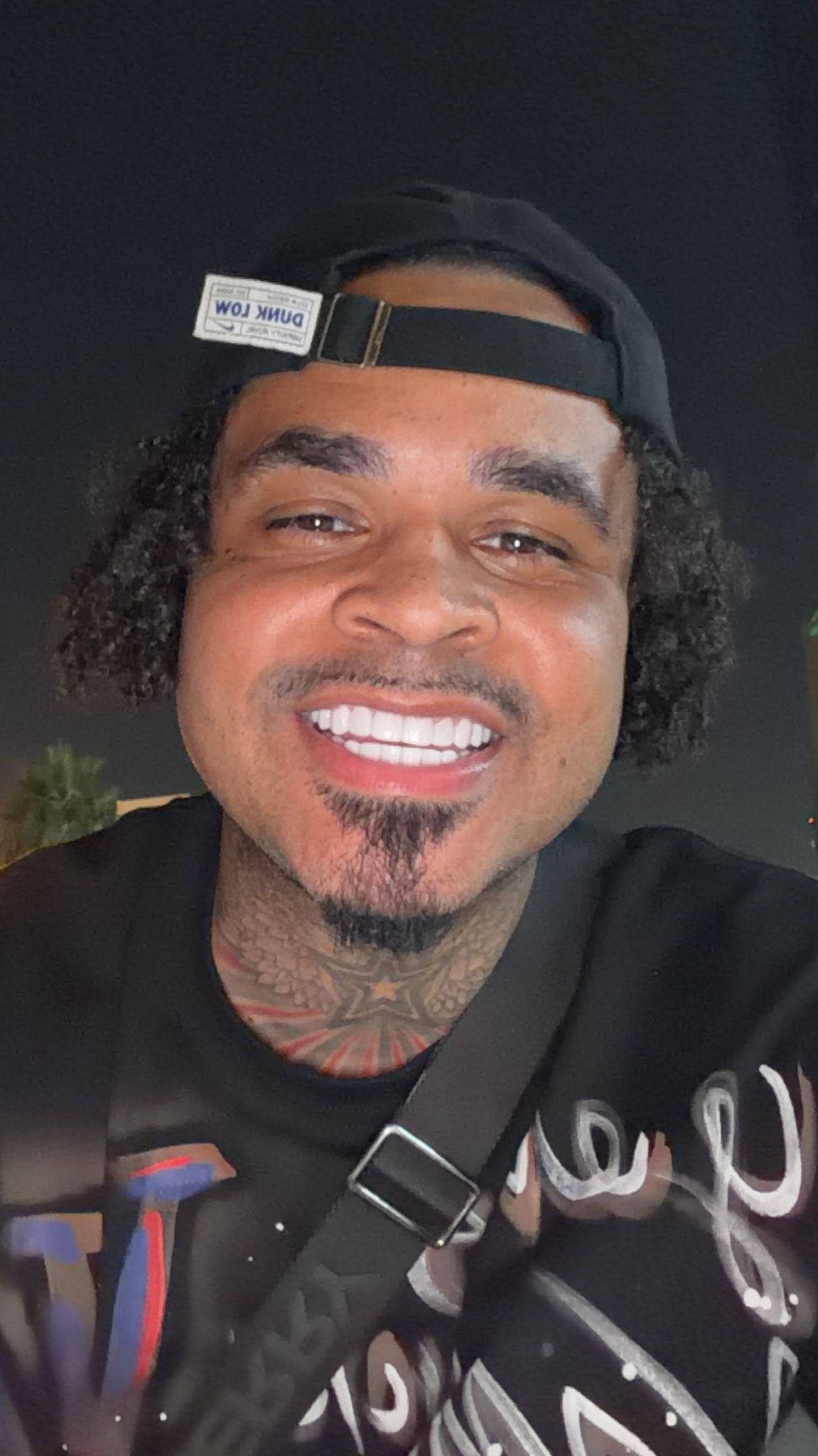 Patient smile after treatment