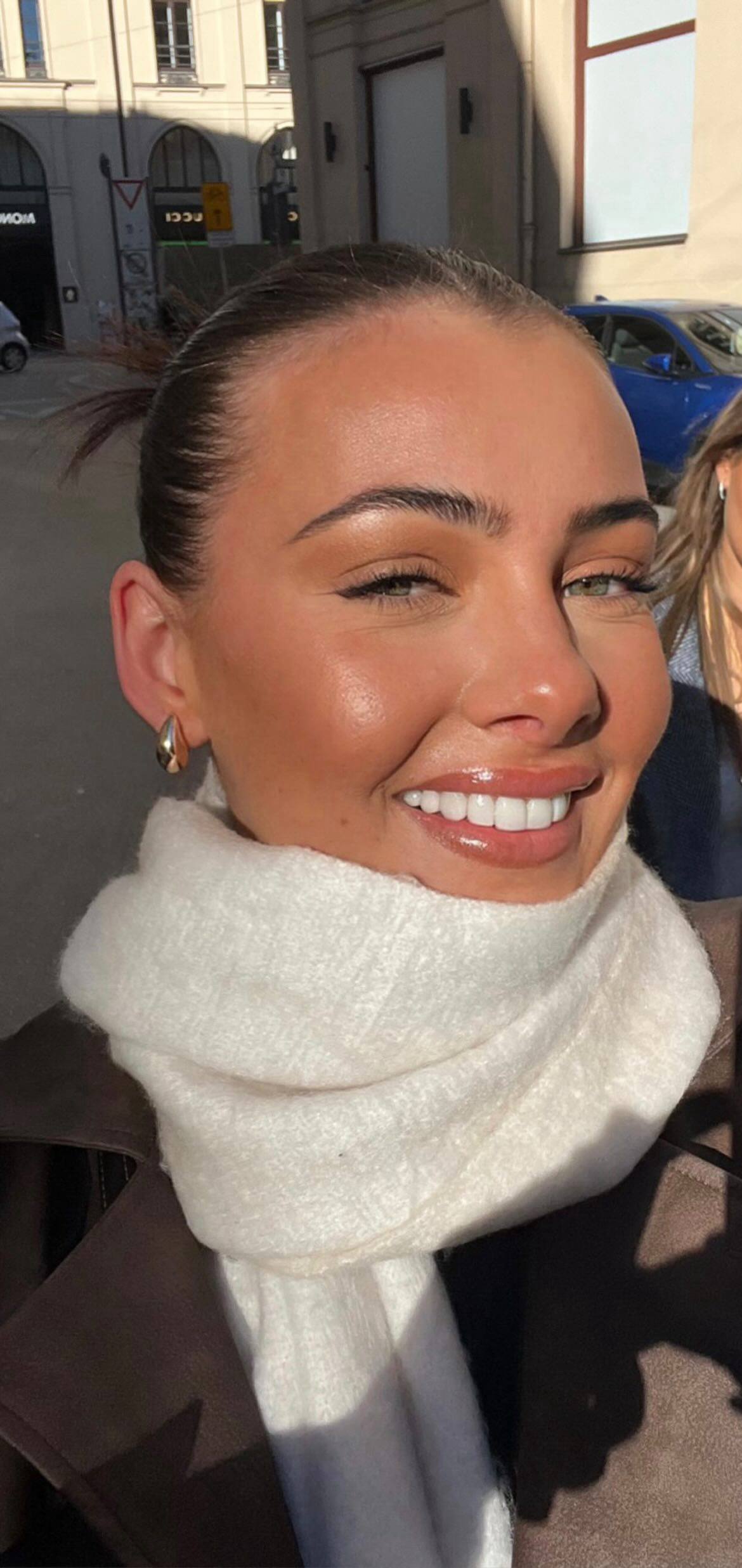Patient smile after treatment